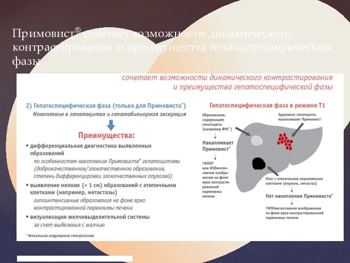 Примовист® сочетает возможности динамического контрастирования и преимущества гепатоспецифической фазы