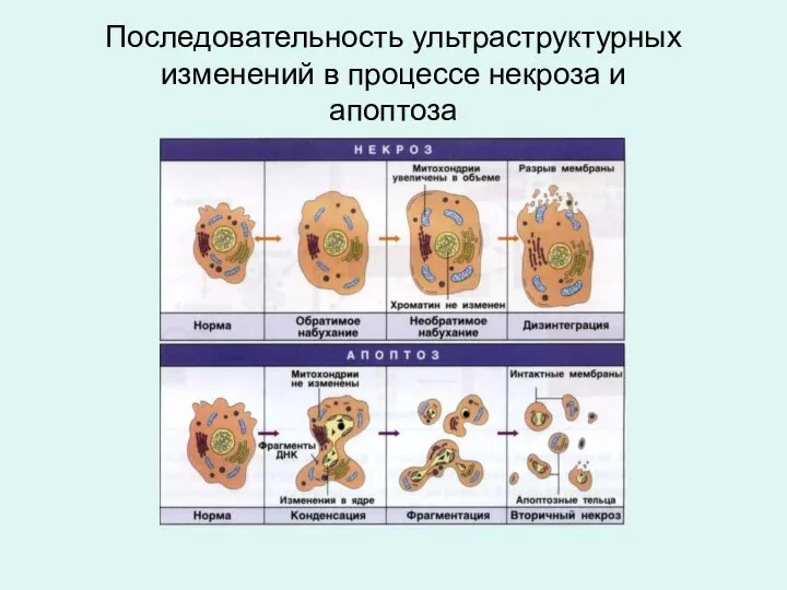 Последовательность ультраструктурных изменений в процессе некроза и апоптоза