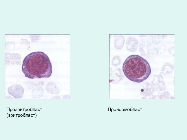 Проэритробласт (эритробласт) Пронормобласт