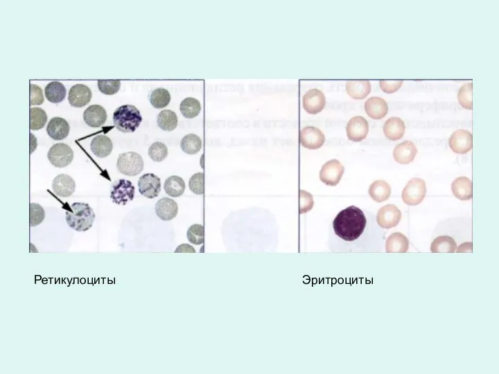Ретикулоциты Эритроциты
