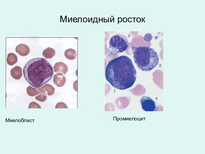 Миелоидный росток Миелобласт Промиелоцит