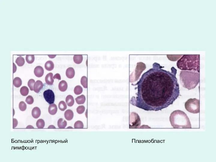 Большой гранулярный лимфоцит Плазмобласт