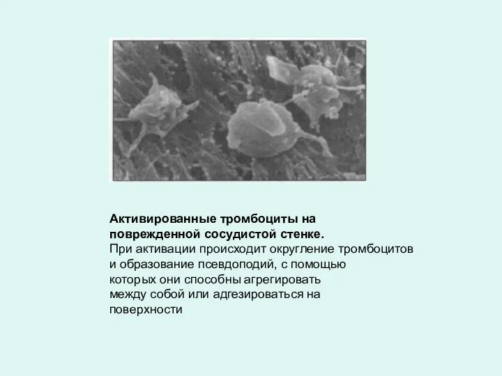 Активированные тромбоциты на поврежденной сосудистой стенке. При активации происходит округление тромбоцитов