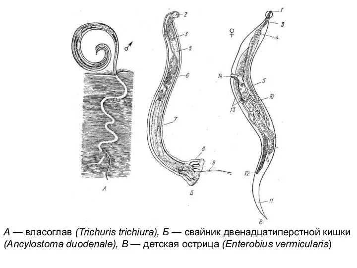 А — власоглав (Trichuris trichiura), Б — свайник двенадцатиперстной кишки (Ancylostoma