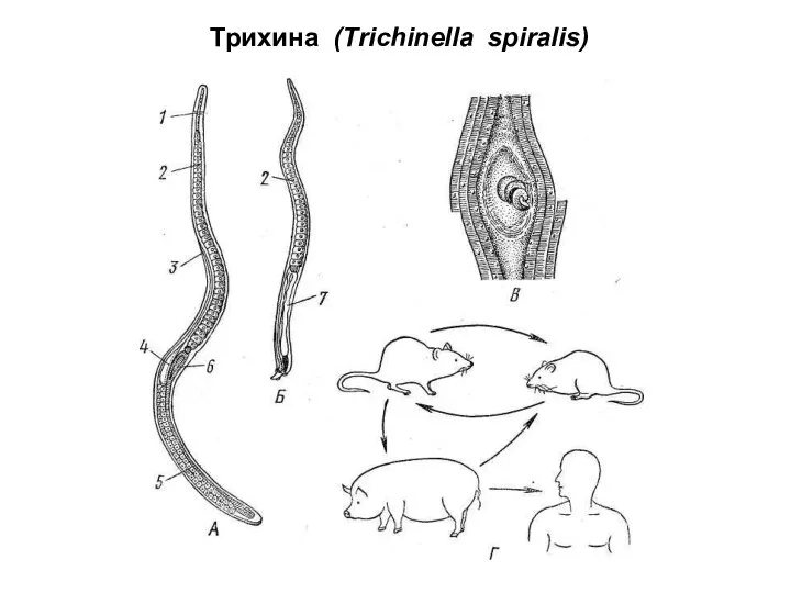 Трихина (Trichinella spiralis)