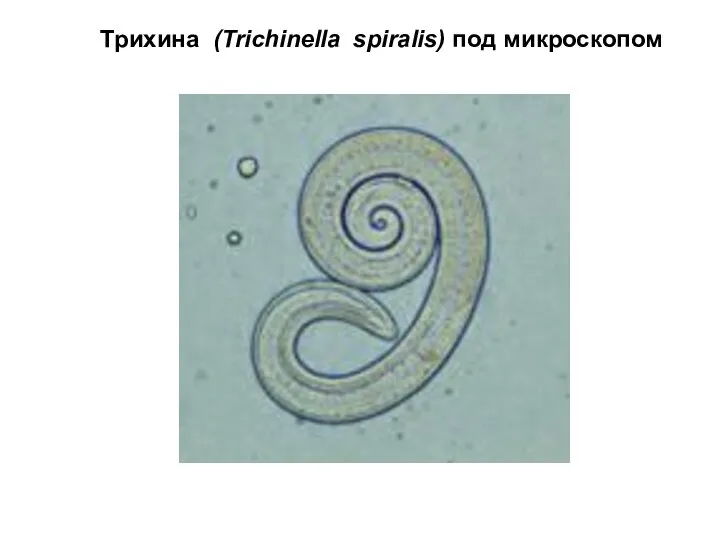 Трихина (Trichinella spiralis) под микроскопом