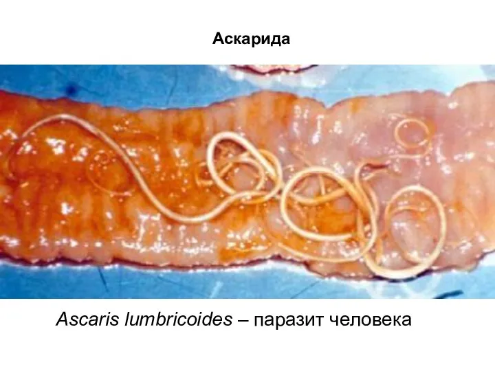 Аскарида Ascaris lumbricoides – паразит человека