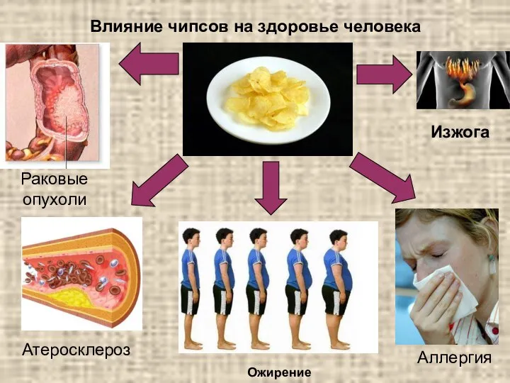 Влияние чипсов на здоровье человека Атеросклероз Ожирение Аллергия Раковые опухоли Изжога