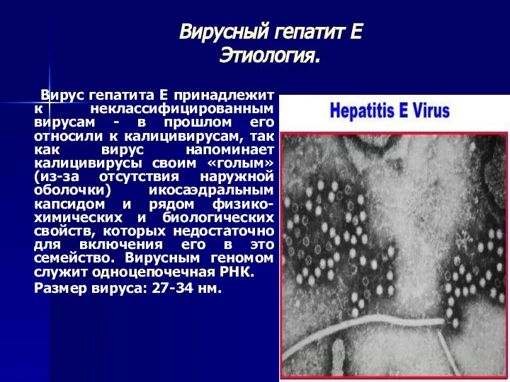 Вирусный гепатит Е Этиология. Вирус гепатита Е принадлежит к неклассифицированным вирусам