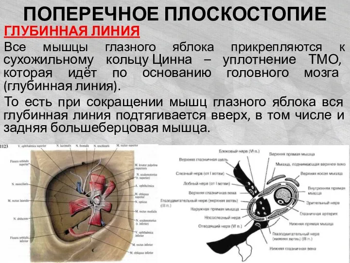 ПОПЕРЕЧНОЕ ПЛОСКОСТОПИЕ ГЛУБИННАЯ ЛИНИЯ Все мышцы глазного яблока прикрепляются к сухожильному