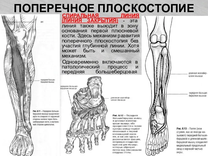 ПОПЕРЕЧНОЕ ПЛОСКОСТОПИЕ СПИРАЛЬНАЯ ЛИНИЯ (ЛИНИЯ ЗАКРЫТИЯ) - эта линия также выходит