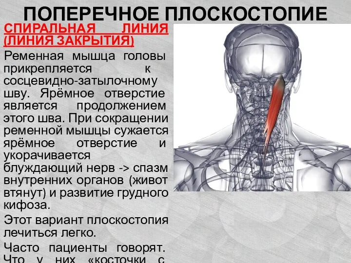 ПОПЕРЕЧНОЕ ПЛОСКОСТОПИЕ СПИРАЛЬНАЯ ЛИНИЯ (ЛИНИЯ ЗАКРЫТИЯ) Ременная мышца головы прикрепляется к