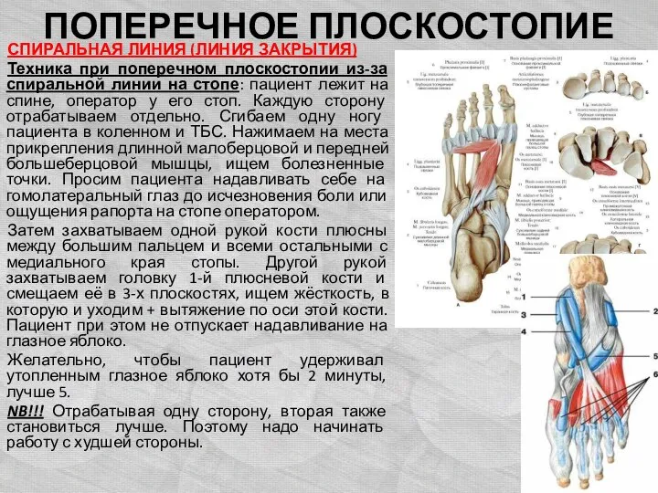 ПОПЕРЕЧНОЕ ПЛОСКОСТОПИЕ СПИРАЛЬНАЯ ЛИНИЯ (ЛИНИЯ ЗАКРЫТИЯ) Техника при поперечном плоскостопии из-за