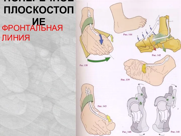 ПОПЕРЕЧНОЕ ПЛОСКОСТОПИЕ ФРОНТАЛЬНАЯ ЛИНИЯ