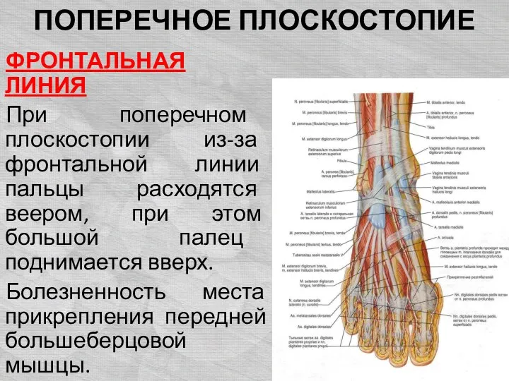 ПОПЕРЕЧНОЕ ПЛОСКОСТОПИЕ ФРОНТАЛЬНАЯ ЛИНИЯ При поперечном плоскостопии из-за фронтальной линии пальцы