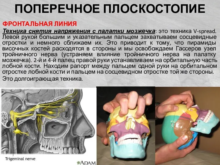 ПОПЕРЕЧНОЕ ПЛОСКОСТОПИЕ ФРОНТАЛЬНАЯ ЛИНИЯ Техника снятия напряжения с палатки мозжечка: это