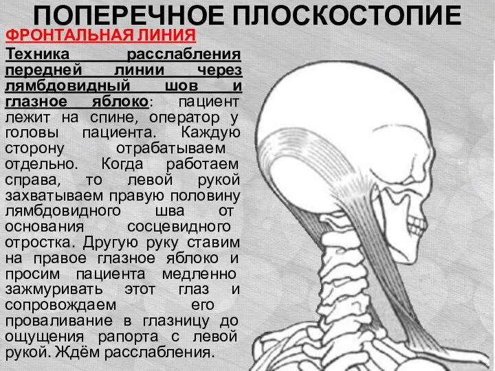 ПОПЕРЕЧНОЕ ПЛОСКОСТОПИЕ ФРОНТАЛЬНАЯ ЛИНИЯ Техника расслабления передней линии через лямбдовидный шов