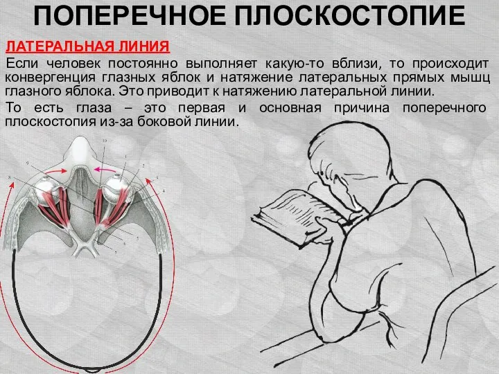 ПОПЕРЕЧНОЕ ПЛОСКОСТОПИЕ ЛАТЕРАЛЬНАЯ ЛИНИЯ Если человек постоянно выполняет какую-то вблизи, то