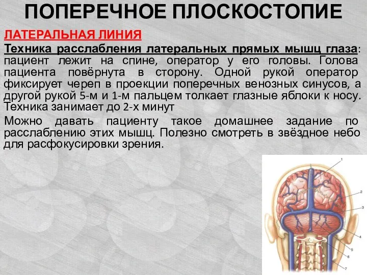 ПОПЕРЕЧНОЕ ПЛОСКОСТОПИЕ ЛАТЕРАЛЬНАЯ ЛИНИЯ Техника расслабления латеральных прямых мышц глаза: пациент