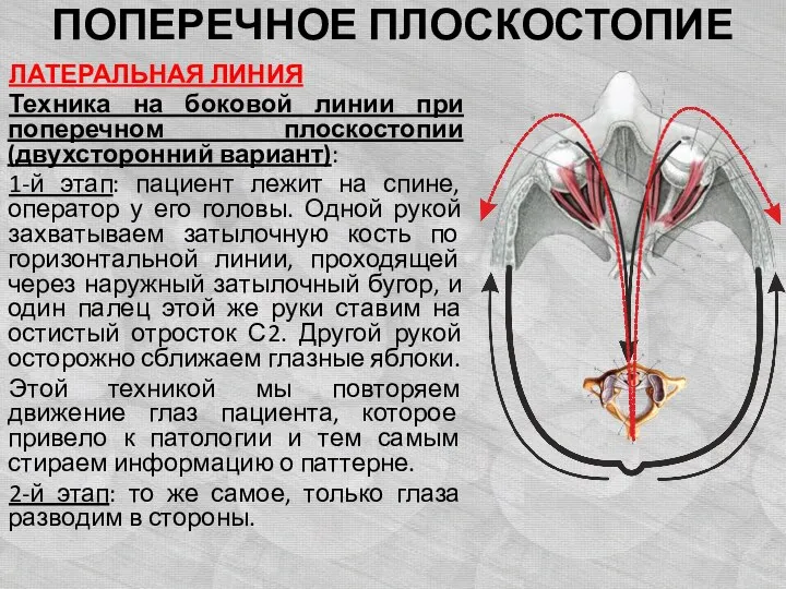 ПОПЕРЕЧНОЕ ПЛОСКОСТОПИЕ ЛАТЕРАЛЬНАЯ ЛИНИЯ Техника на боковой линии при поперечном плоскостопии