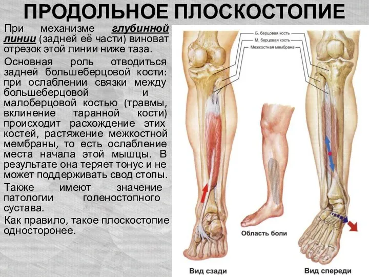 ПРОДОЛЬНОЕ ПЛОСКОСТОПИЕ При механизме глубинной линии (задней её части) виноват отрезок