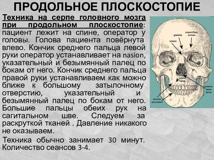 ПРОДОЛЬНОЕ ПЛОСКОСТОПИЕ Техника на серпе головного мозга при продольном плоскостопие: пациент