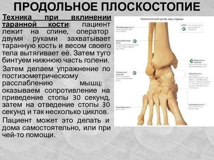 ПРОДОЛЬНОЕ ПЛОСКОСТОПИЕ Техника при вклинении таранной кости: пациент лежит на спине,