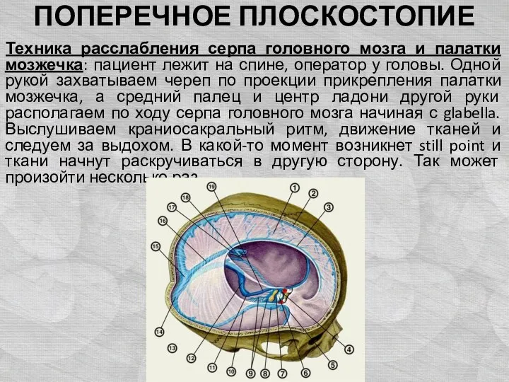 ПОПЕРЕЧНОЕ ПЛОСКОСТОПИЕ Техника расслабления серпа головного мозга и палатки мозжечка: пациент