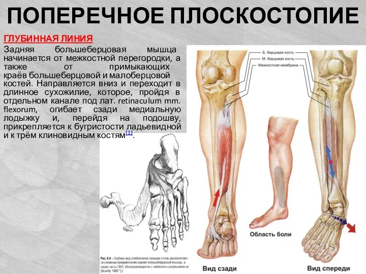 ПОПЕРЕЧНОЕ ПЛОСКОСТОПИЕ ГЛУБИННАЯ ЛИНИЯ Задняя большеберцовая мышца начинается от межкостной перегородки,