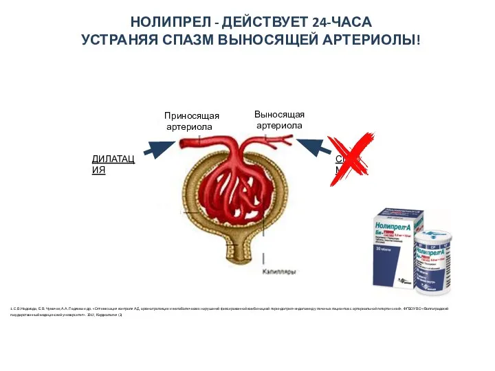 НОЛИПРЕЛ - ДЕЙСТВУЕТ 24-ЧАСА УСТРАНЯЯ СПАЗМ ВЫНОСЯЩЕЙ АРТЕРИОЛЫ! Приносящая артериола Выносящая