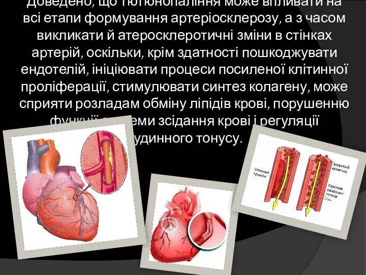 Доведено, що тютюнопаління може впливати на всі етапи формування артеріосклерозу, а