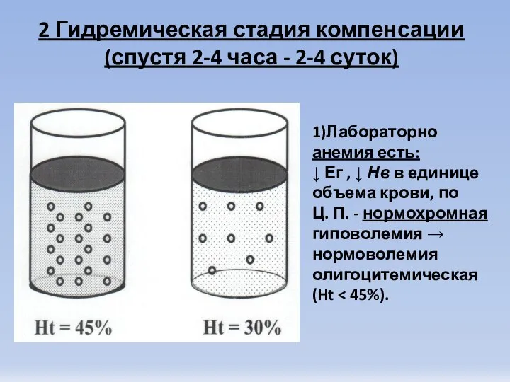 2 Гидремическая стадия компенсации (спустя 2-4 часа - 2-4 суток) 1)Лабораторно