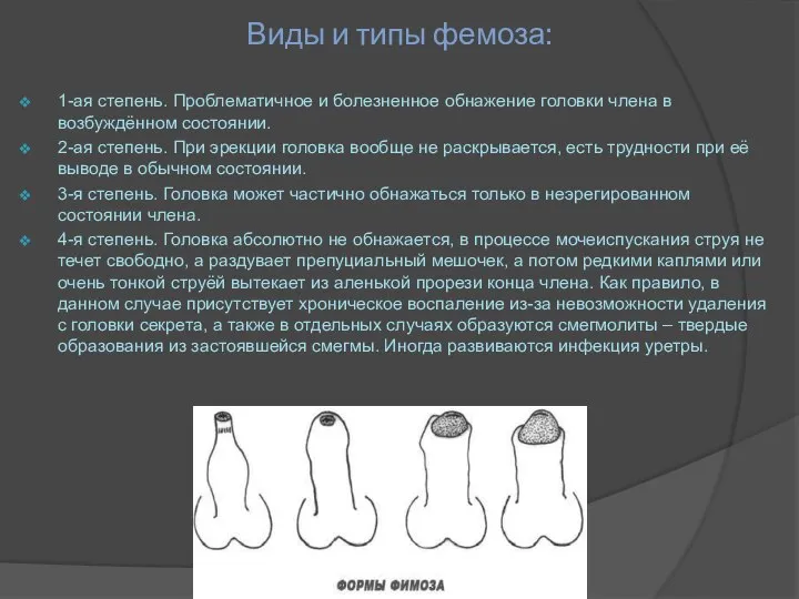 Виды и типы фемоза: 1-ая степень. Проблематичное и болезненное обнажение головки