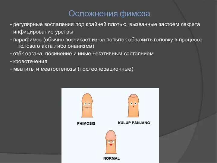 Осложнения фимоза - регулярные воспаления под крайней плотью, вызванные застоем секрета