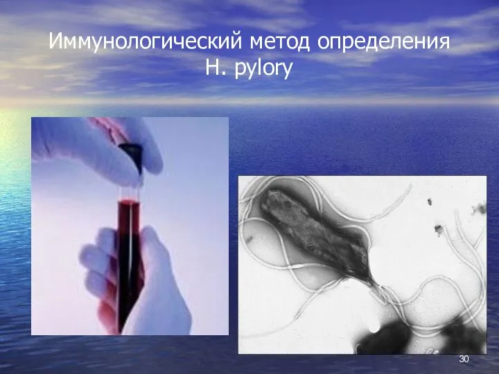 Иммунологический метод определения H. pylory