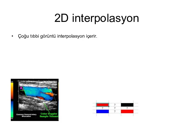 2D interpolasyon Çoğu tıbbi görüntü interpolasyon içerir.