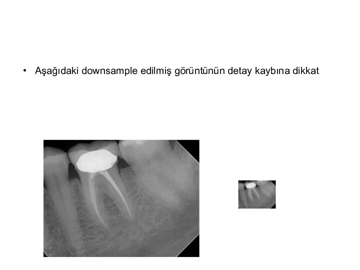 Aşağıdaki downsample edilmiş görüntünün detay kaybına dikkat