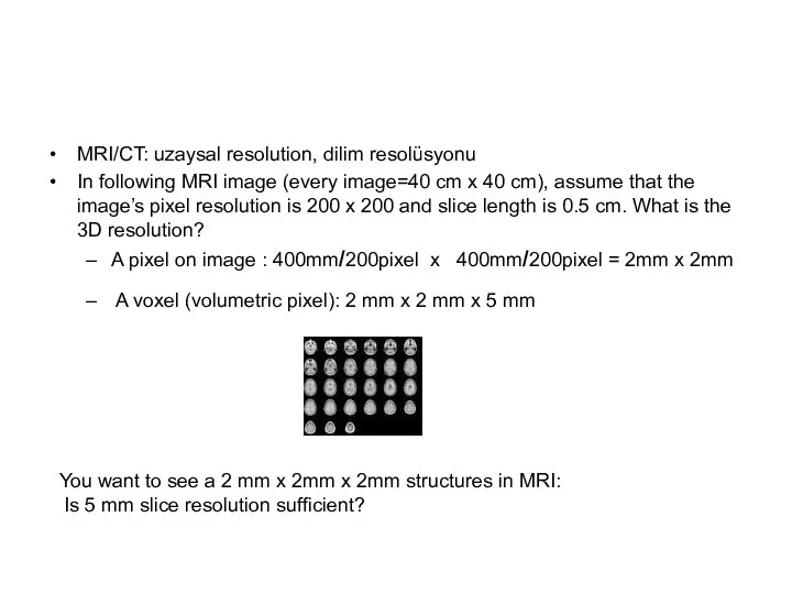 MRI/CT: uzaysal resolution, dilim resolüsyonu In following MRI image (every image=40