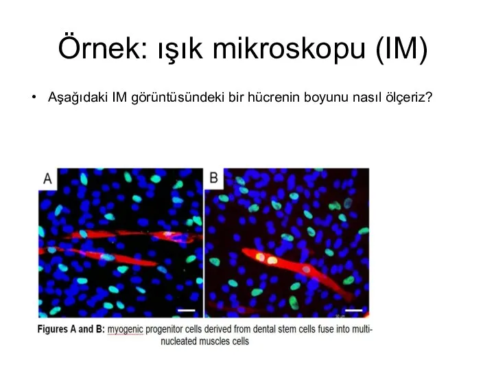 Örnek: ışık mikroskopu (IM) Aşağıdaki IM görüntüsündeki bir hücrenin boyunu nasıl ölçeriz?