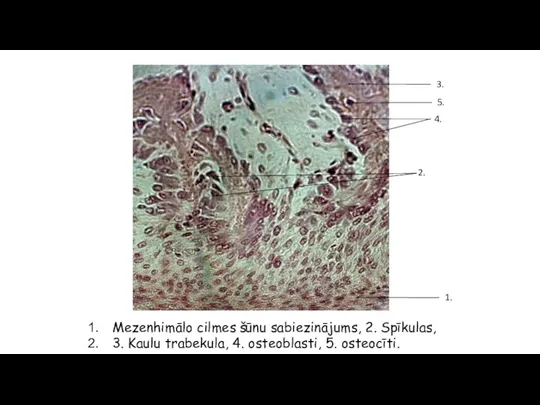 Mezenhimālo cilmes šūnu sabiezinājums, 2. Spīkulas, 3. Kaulu trabekula, 4. osteoblasti,