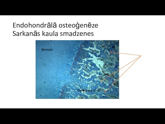 Endohondrālā osteoģenēze Sarkanās kaula smadzenes Skrimslis Osifikācijas zona