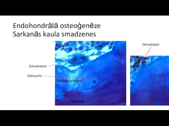 Endohondrālā osteoģenēze Sarkanās kaula smadzenes Osteoklasts Osteocīts Osteoīds Skrimšļa atliekas Osteoblasti