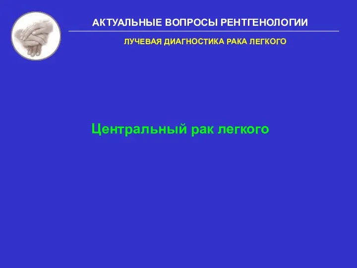 АКТУАЛЬНЫЕ ВОПРОСЫ РЕНТГЕНОЛОГИИ Центральный рак легкого ЛУЧЕВАЯ ДИАГНОСТИКА РАКА ЛЕГКОГО