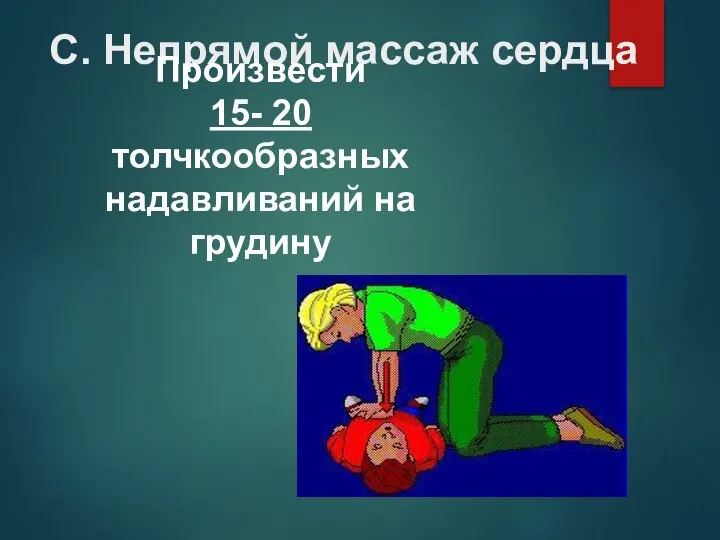 С. Непрямой массаж сердца Произвести 15- 20 толчкообразных надавливаний на грудину