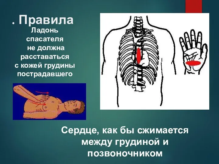 Ладонь спасателя не должна расставаться с кожей грудины пострадавшего Сердце, как