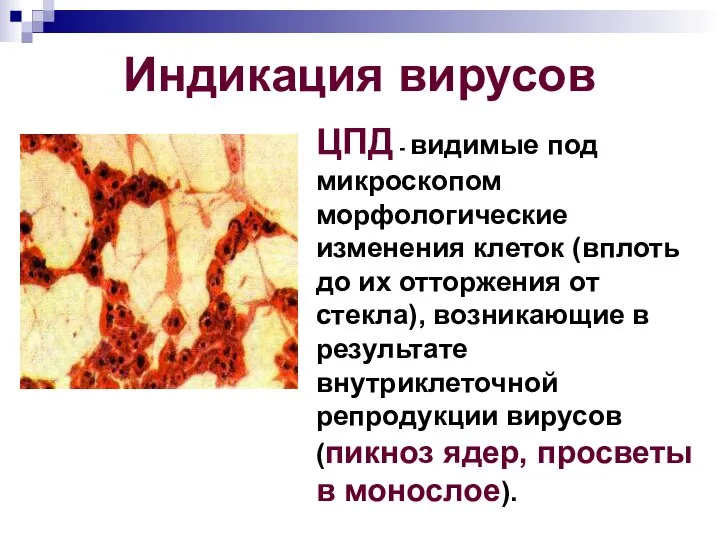 Индикация вирусов ЦПД - видимые под микроскопом морфологические изменения клеток (вплоть