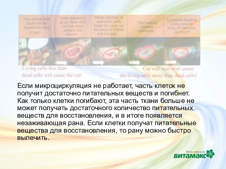 Если микроциркуляция не работает, часть клеток не получит достаточно питательных веществ