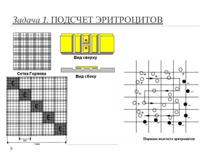 Задача 1. ПОДСЧЕТ ЭРИТРОЦИТОВ