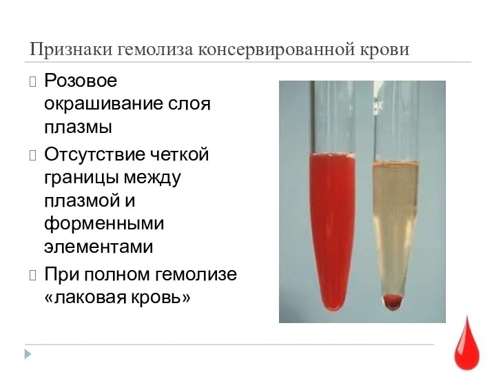 Признаки гемолиза консервированной крови Розовое окрашивание слоя плазмы Отсутствие четкой границы