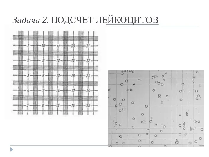 Задача 2. ПОДСЧЕТ ЛЕЙКОЦИТОВ